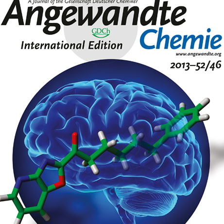 Optic Nerve - Preview