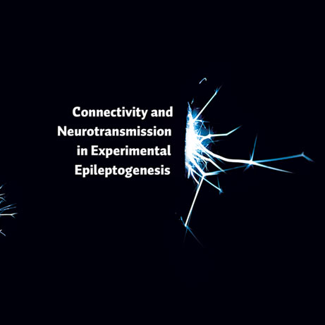 Optic Nerve - Preview