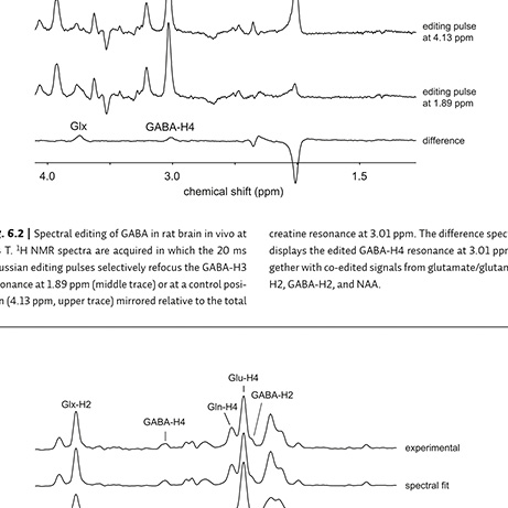 Optic Nerve - Preview