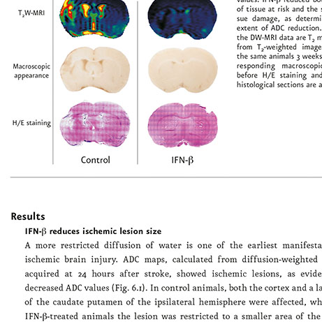 Optic Nerve - Preview