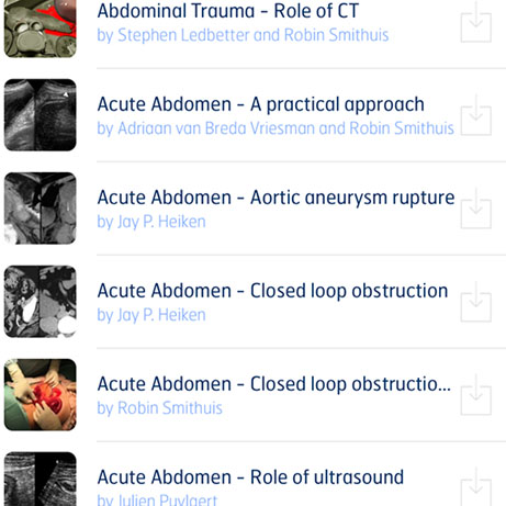 Optic Nerve - Preview