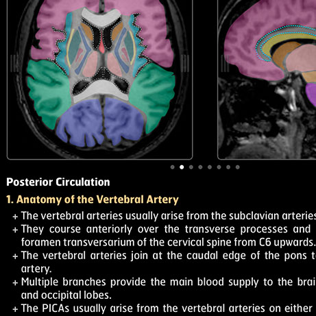 Optic Nerve - Preview