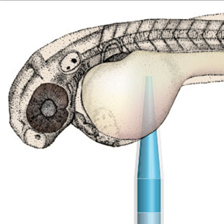Optic Nerve - Preview