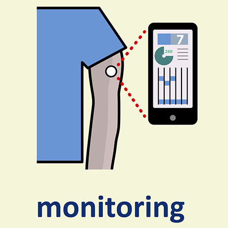 Optic Nerve - Preview