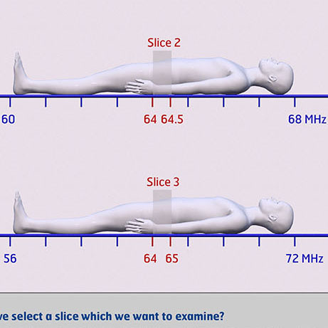 Optic Nerve - Preview