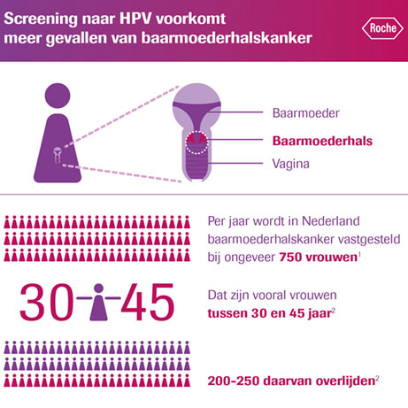 Optic Nerve - Preview