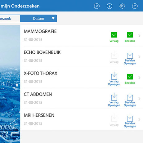 Optic Nerve - Preview