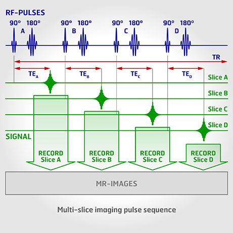Optic Nerve - Preview