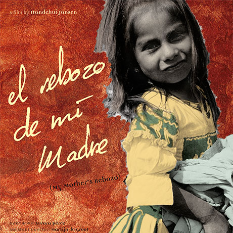 Optic Nerve - Preview